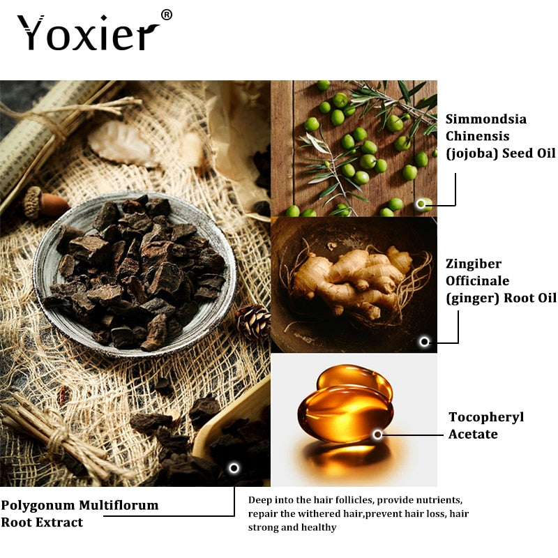 Yoxier 3Pcs Hair Growth Essence Oil Effective Extract Anti Nourish Hair Roots Treatment Preventing Hair Loss Hair Care Products