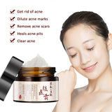 Herbal Acne Cream Anti Pimple Spot Acne Scars Blackhead Removal Cream Whitening Beauty Skin Face Care Creams Acne Treament TSLM1