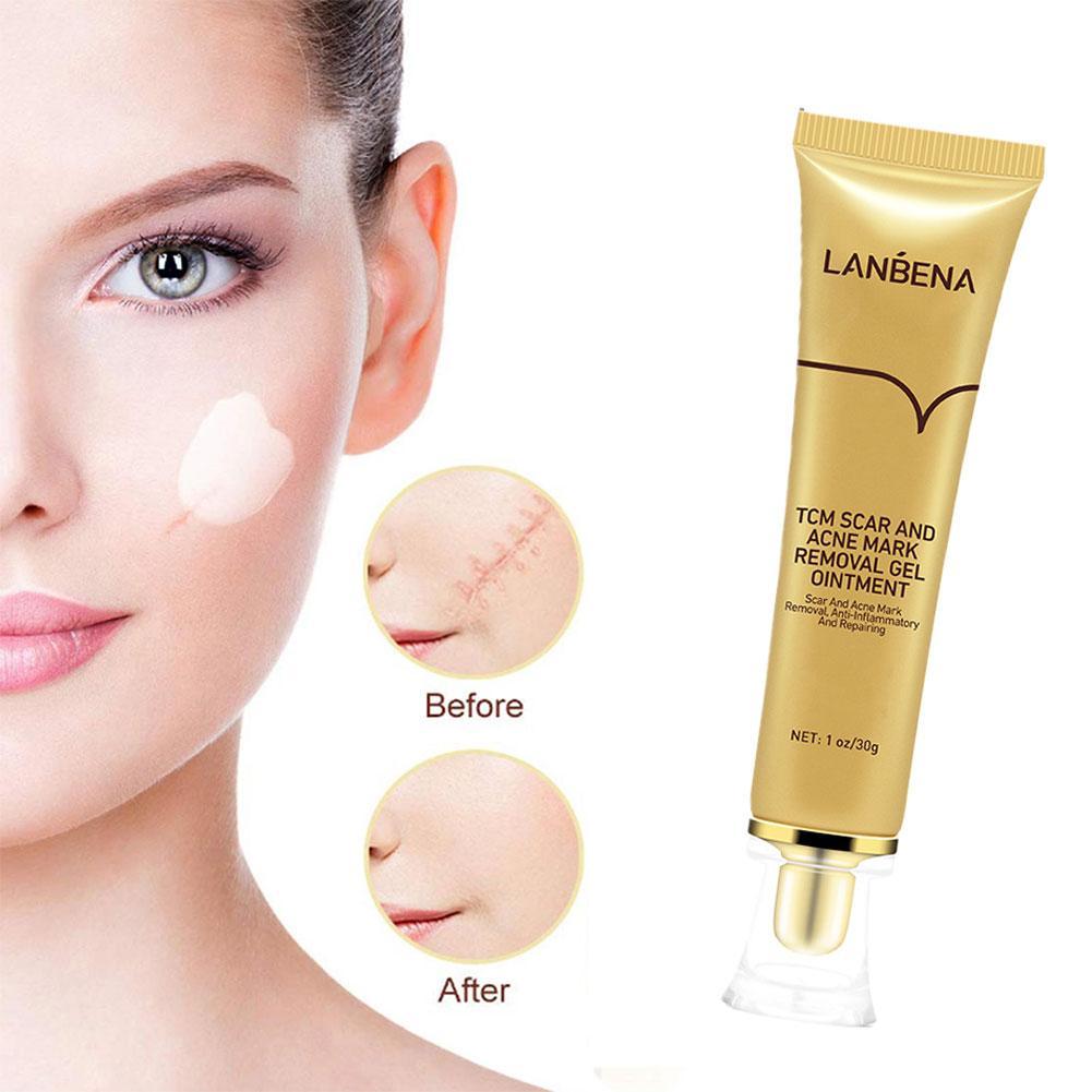 LANBENA Acne Scar Removal Cream Cosmetics For Face Screm TCM Herbal Repair Stretch Marks Remove Scar Treatment Bioaqua Skin Care