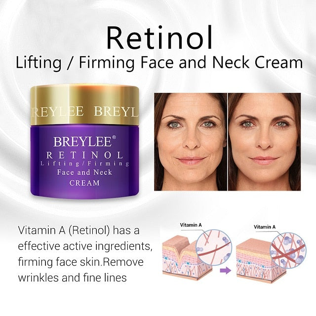 BREYLEE Vitamin C 20% VC Whitening Facial Cream Repair Fade Freckles Remove Dark Spots Melanin Remover Brightening Face Cream