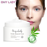 OMY LADY Freckle Removal Cream Remove Freckle Pregnant Spots Melanin Dark Spot Anti Aging Whitening Facial Cream Brightening