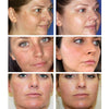 BREYLEE Vitamin C 20% VC Whitening Facial Cream Repair Fade Freckles Remove Dark Spots Melanin Remover Brightening Face Cream