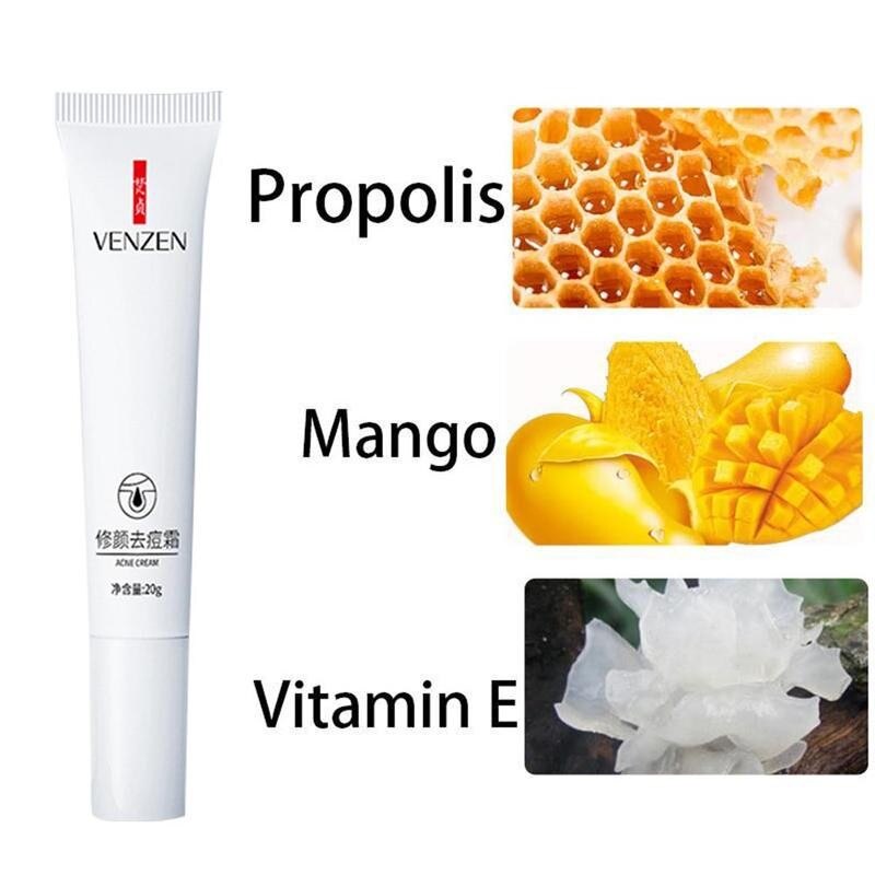 Acne Treatment Face Cream Anti Acne Oil Control Shrink Moisturizer Cream Pores Pimple Care Removal Skin Stretch Whitening M H5F4