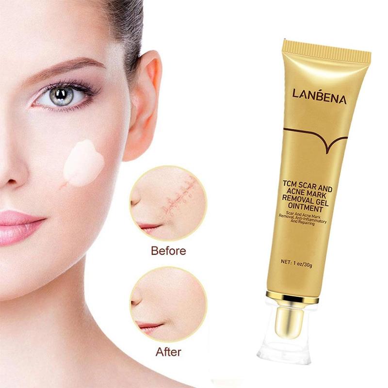 LANBENA Acne Scar Removal Cream Cosmetics For Face Screm TCM Herbal Repair Stretch Marks Remove Scar Treatment Bioaqua Skin Care