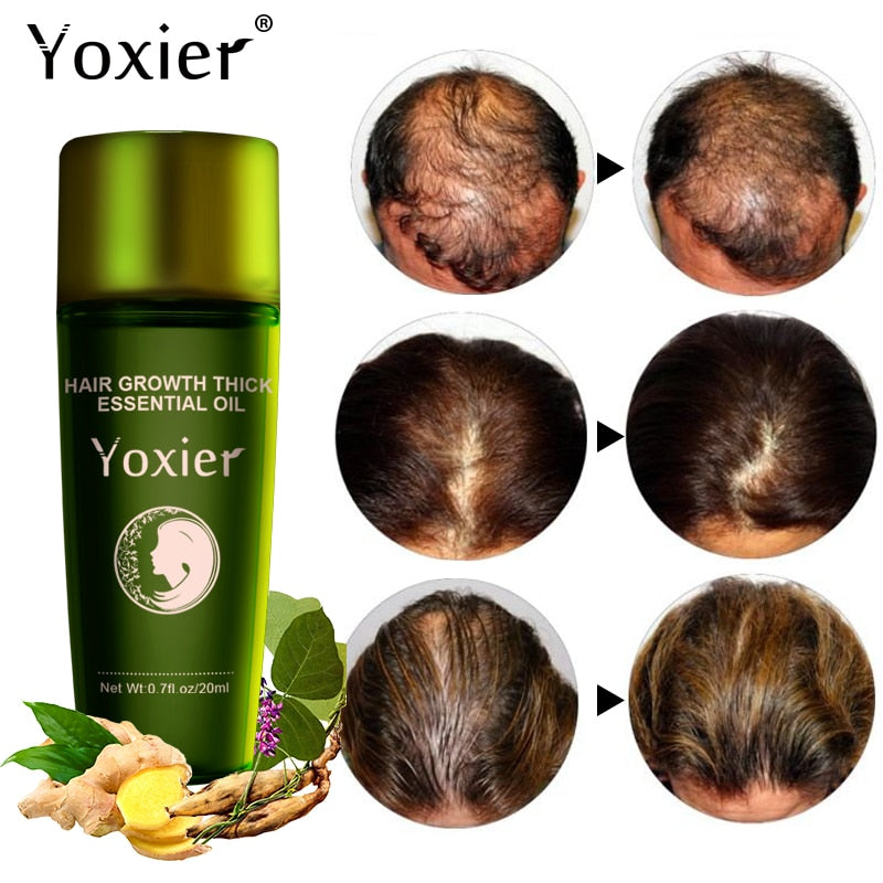 Yoxier 3Pcs Hair Growth Essence Oil Effective Extract Anti Nourish Hair Roots Treatment Preventing Hair Loss Hair Care Products