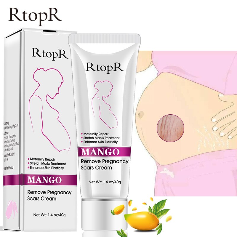 Mango Remove Pregnancy Scars Acne Cream Stretch Marks Treatment Maternity Repair Anti-Aging Anti Winkles Firming Body Creams