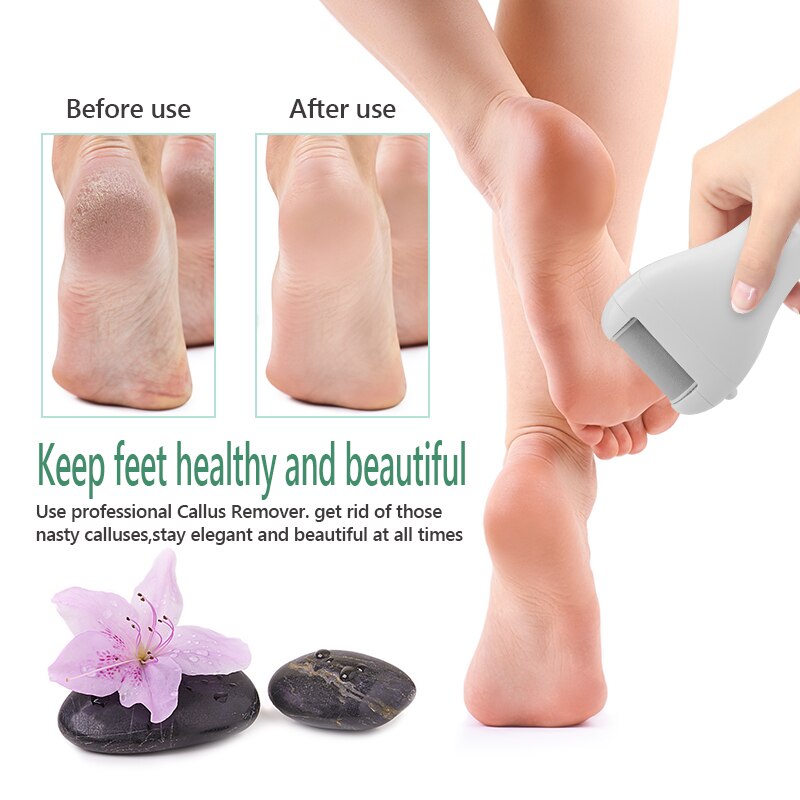 Waterproof USB Rechargeable Electric Pedicure Tools Foot Care Machine Callus Remover Dead Skin Remover Foot File Heel Cleaner