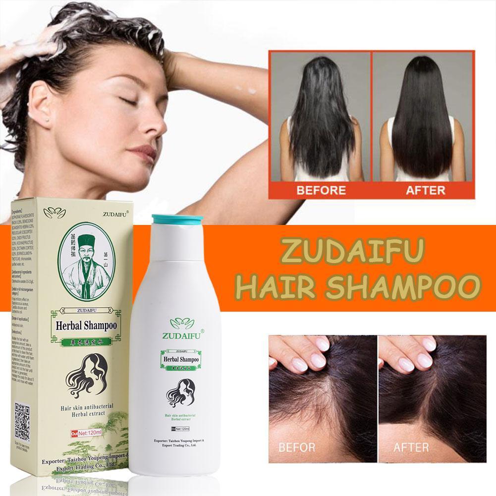 120ML Zudaifu Hair Psoriasis Seborrheic Skin Care Treatment Dermatitis Eczema Compound Herbal Shampoo Repair Hair Care