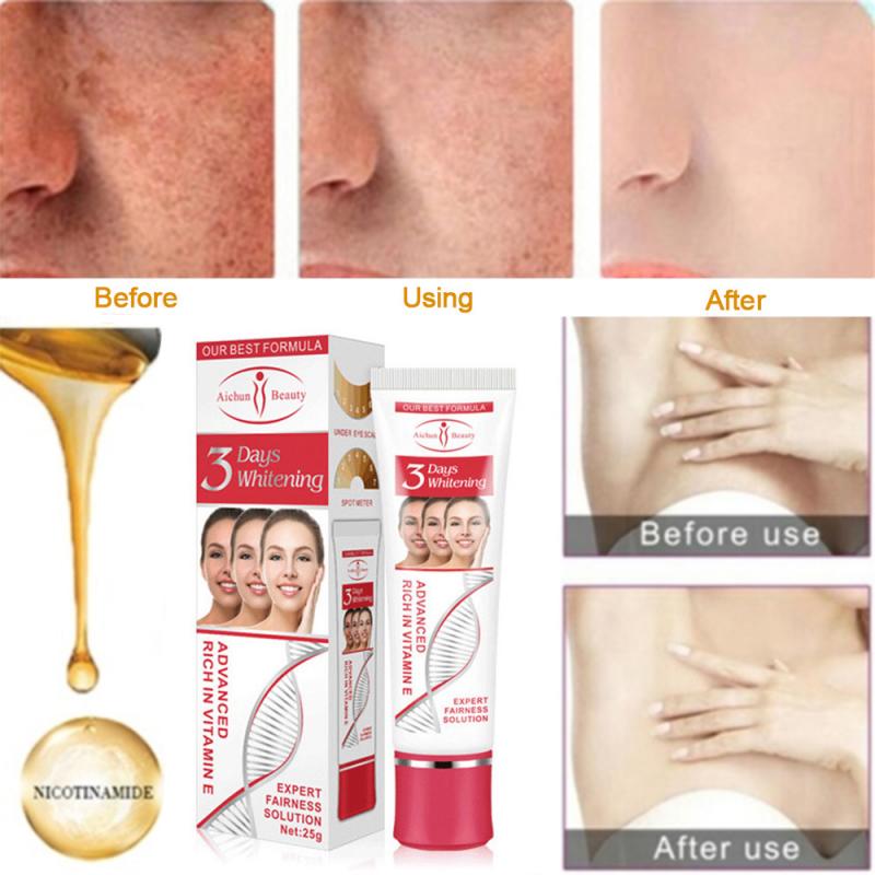 Face Cream Retinol Freckles Cream Age Spots Skin Whitening Strong Effect Dark Spots Melasma Lightening Face Cream TSLM1 Dropship