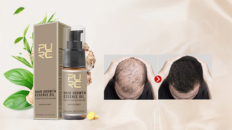 PURC Ginger Hair Growth Products Fast Growing Spray Scalp Treatment Oil Beauty Health Hair Care for Men Women 30ml