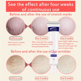 Smooth Skin Cream Fat wrinkles Pregnancy Removal To Maternity Skin Repair Body Cream Soft Skin Stretch Marks Scar Removal Creams
