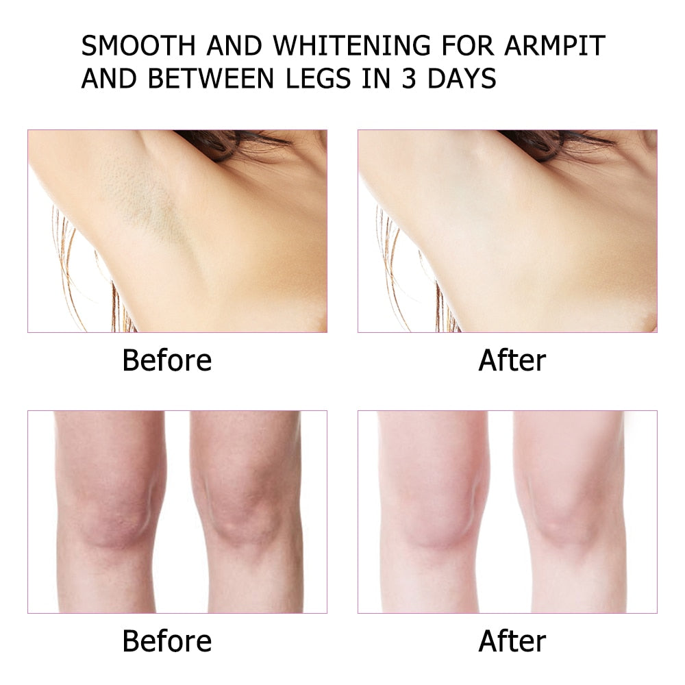 Underarm Whitening Cream Armpit Whitening Cream Legs Knees Private Parts Body Whitening Cream Intimate Body Skin Care Creams