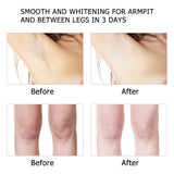 Underarm Whitening Cream Armpit Whitening Cream Legs Knees Private Parts Body Whitening Cream Intimate Body Skin Care Creams