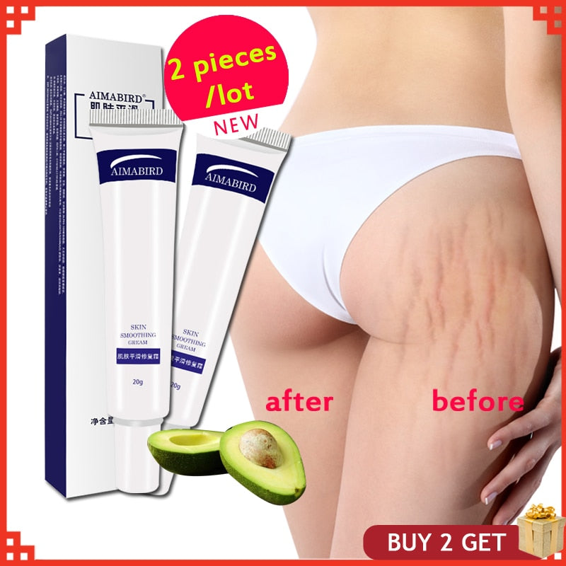 Smooth Skin Cream Fat wrinkles Pregnancy Removal To Maternity Skin Repair Body Cream Soft Skin Stretch Marks Scar Removal Creams