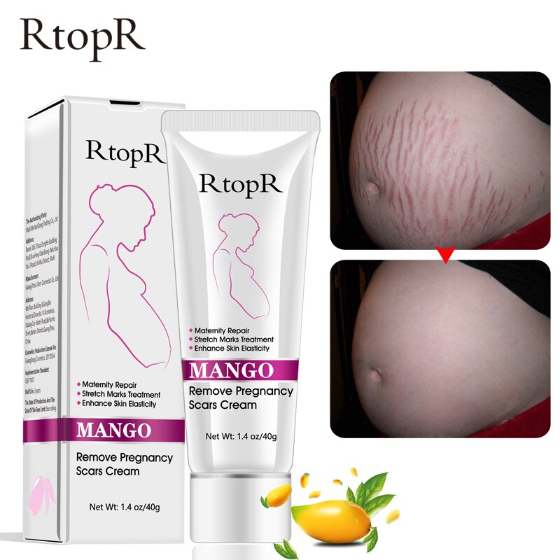 Mango Remove Pregnancy Scars Acne Cream Stretch Marks Treatment Maternity Repair Anti-Aging Anti Winkles Firming Body Creams