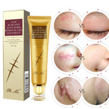 Acne Scar Removal Cream Gel Face Pimples Stretch Marks Cream Repairing Smoothing Whitening Moisturizing Body Cream Skin Care 30g