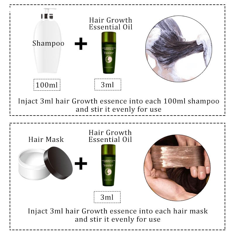 Yoxier 3Pcs Hair Growth Essence Oil Effective Extract Anti Nourish Hair Roots Treatment Preventing Hair Loss Hair Care Products