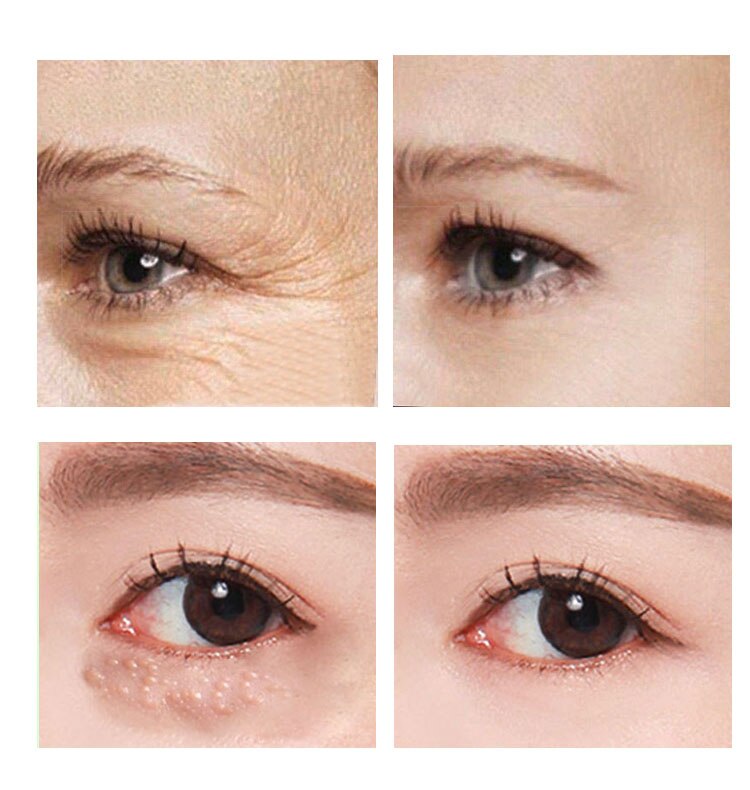 VOVA Remove Eye bags Cream Retinol Cream Anti Face Moisturizer Gel Dark Circles Delay aging fades wrinkles Firming Brighten Skin