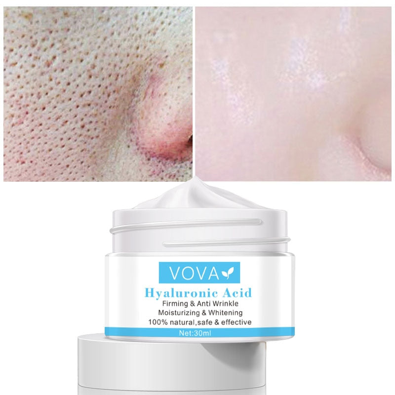 VOVA Hyalurionic Pore Shrinking Cream Hyaluronic Acid Pores Treatment Relieve Dryness Oil-Control Firming Moisturizing Whitening