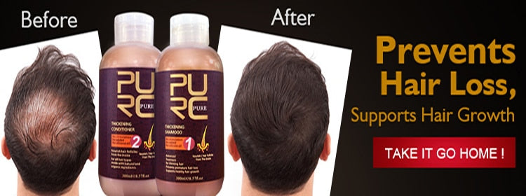 PURC Ginger Hair Growth Products Fast Growing Spray Scalp Treatment Oil Beauty Health Hair Care for Men Women 30ml