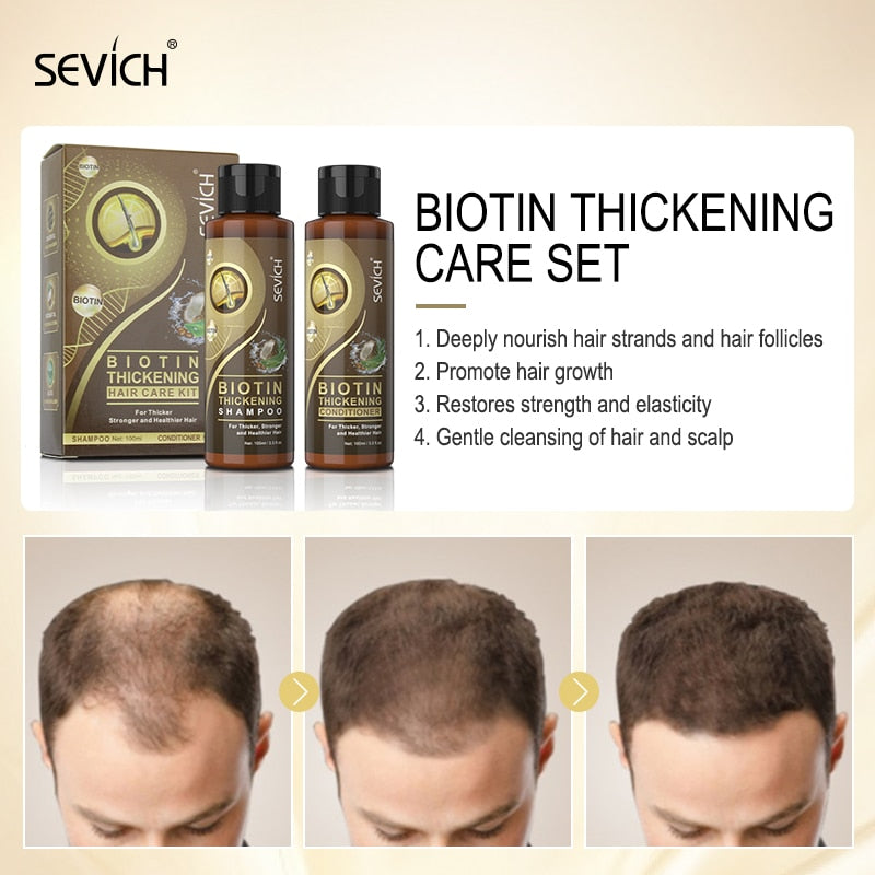 Sevich 2PCS/SET Biotin Thickening Hair Care Kit 100ml Anti-Hair Loss Hair Shampoo Stronger & Growing Hair Moisturing Conditioner