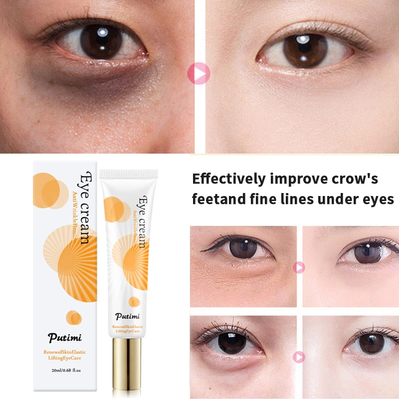 PUTIMI Anti-Aging Eye Cream Remove Dark Circles Puffiness And Bags Lighten Fine Lines Whitening Moisturizing Eye Creams Eye Care