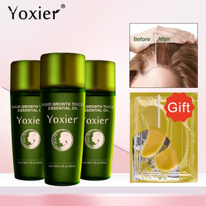Yoxier 3Pcs Hair Growth Essence Oil Effective Extract Anti Nourish Hair Roots Treatment Preventing Hair Loss Hair Care Products