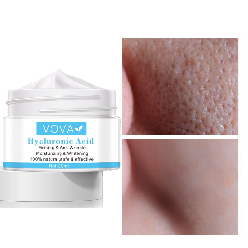 VOVA Hyalurionic Pore Shrinking Cream Hyaluronic Acid Pores Treatment Relieve Dryness Oil-Control Firming Moisturizing Whitening