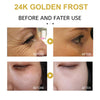 24K Gold Face Cream Acne Pimple Mark Removal Dark Spots Whitening Facial Creams Mask Moisturizing Day Cream 30g Skin Care Creams