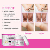 Body Whitening Cream Underarm Armpit Knee Dark Skin Bleaching Cream Lighten Melanin Dull Moisturizing Brighten Skin Care Lotion