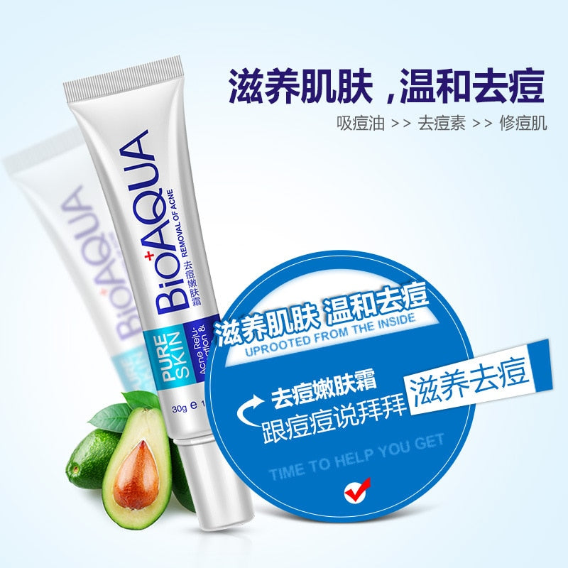 BIOAQUA Anti Acne Cream Oil Control Shrink Pores Nourish Moisturizer Acne Scar Remove Acne Treatment Face Cream 30g TSLM1