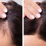 Onion Black Seed Hair Oil Spray for Natural Hair Care and Growth Prevent Hair Loss Biotin Fast Hair Growth