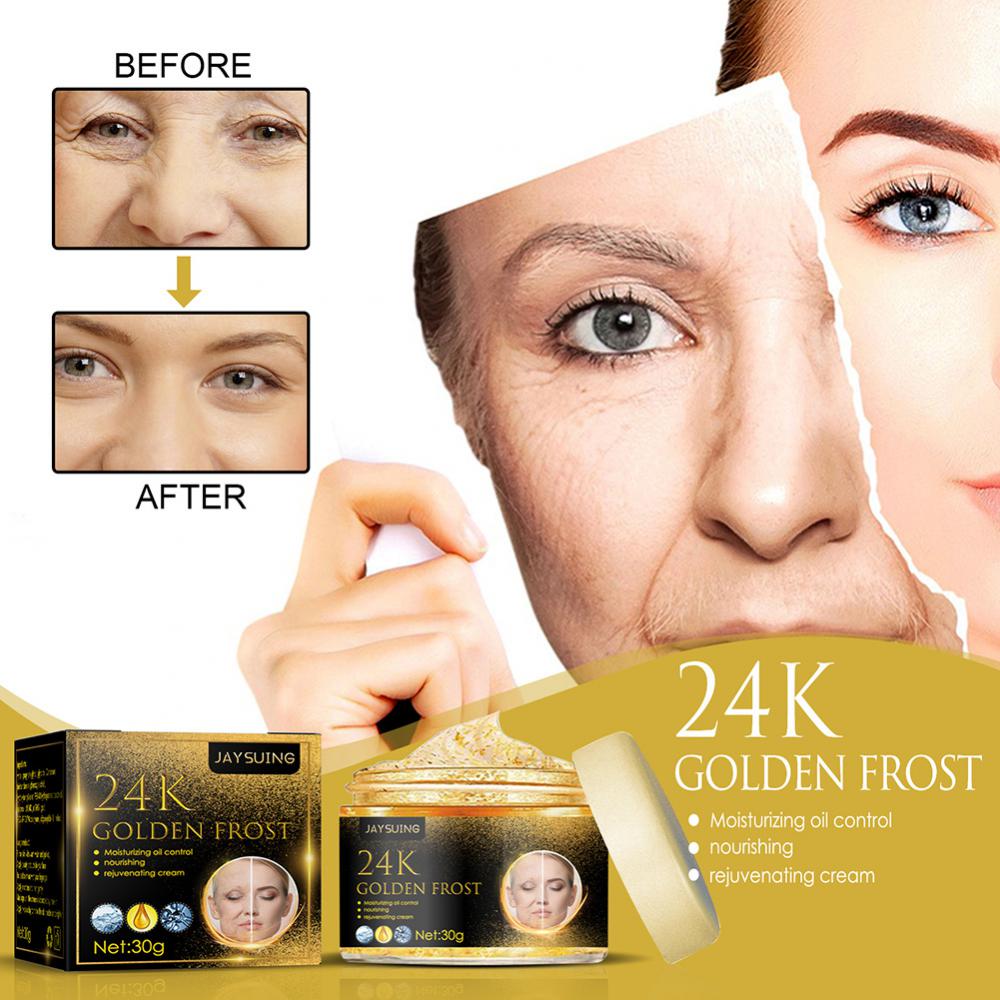 24K Gold Face Cream Acne Pimple Mark Removal Dark Spots Whitening Facial Creams Mask Moisturizing Day Cream 30g Skin Care Creams