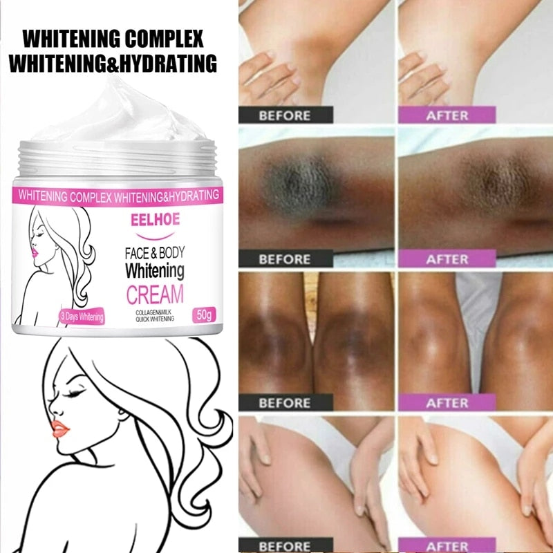 Body Whitening Cream Underarm Armpit Knee Dark Skin Bleaching Cream Lighten Melanin Dull Moisturizing Brighten Skin Care Lotion